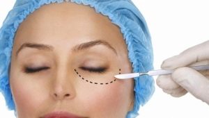 The process of blepharoplasty lower eyelids