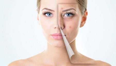 How to care for problem skin?