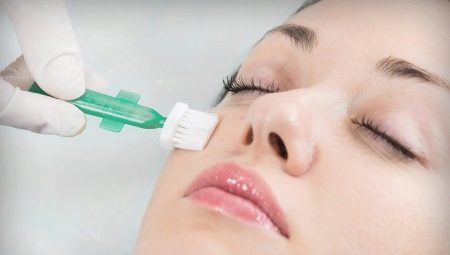 Chemical peeling: when and how can it be done?