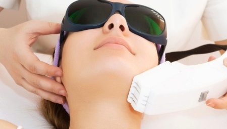 Laser peeling: description of the procedure, benefits and harm from it