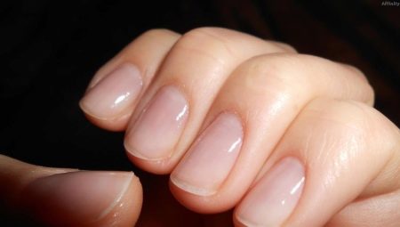 Làm thế nào để phục hồi móng sau khi mở rộng?