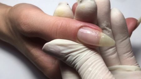 Nagtatampok ng pagbuo ng sirang kuko