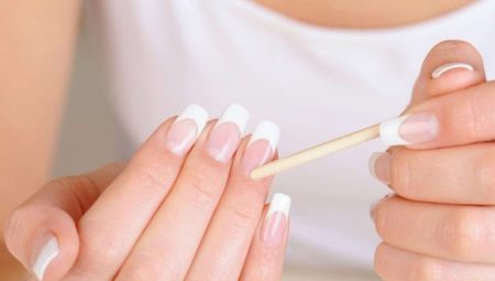 Ma trận móng: mô tả, cấu trúc và nguyên nhân thiệt hại