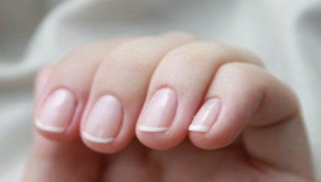 Nguyên nhân và điều trị viêm lớp biểu bì móng tay