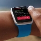 Smart bracelet with pulse and pressure measurement