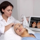 Features SMAS-lifting Ulthera System
