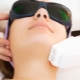 Laser peeling: description of the procedure, benefits and harm from it