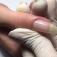 Features building a broken nail