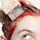 Allergy sa hair dye