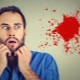 Hemophobia: Mô tả, nguyên nhân và điều trị