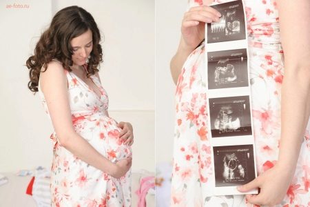 Photo of pregnant with ultrasound